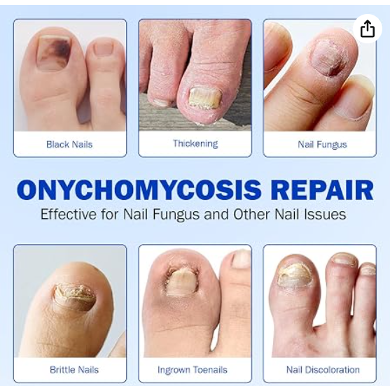 Fungal Nail Patches