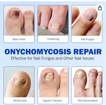 Fungel Nail Patches