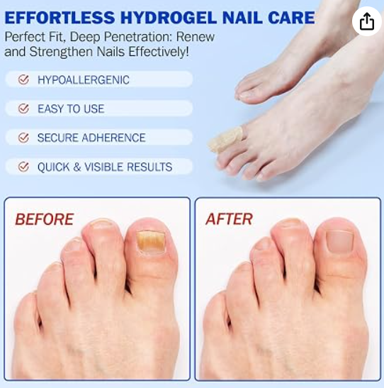 Fungal Nail Patches